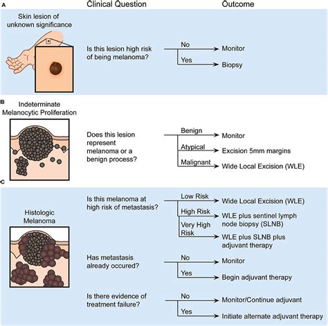 melanoma pathology reporting and staging